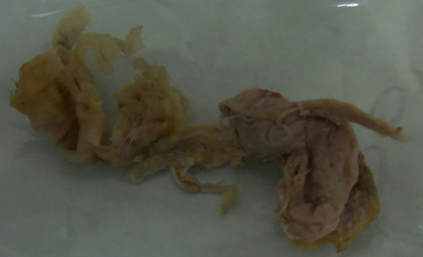 Figura 1. Cuadro asfíctico. Restos de comida expulsados.