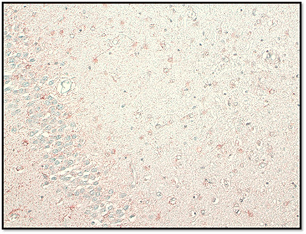 Figura 9. Beta Amiloide: No se identifican placas a nivel cortical, sistema límbico, ganglios de la base ni mesencéfalo.
