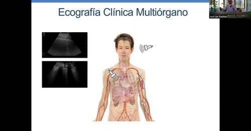 <p>III SESIÓN NACIONAL DE GERIATRÍA SOBRE ECOGRAFÍA CLÍNICA EN GERIATR&I