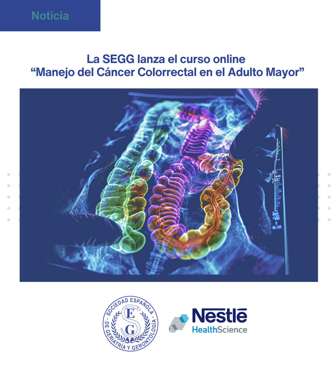 <p>La SEGG lanza el curso online Manejo del C&aacute;ncer Colorrectal en el Adulto Mayor</p>