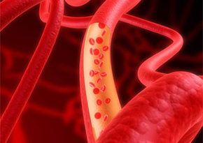 Arterias